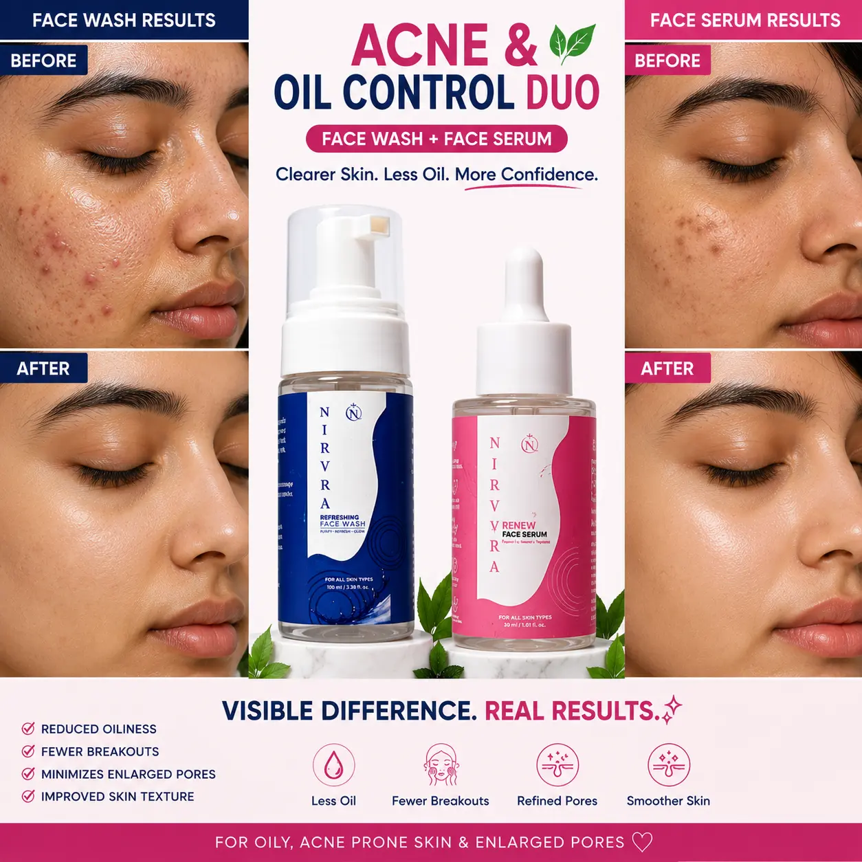 Nirvra Acne & Oil Control Duo | Brightening Face Serum + Refreshing Face Wash - Image 3